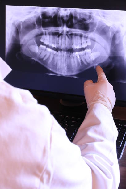 Best Emergency Dentist for Knocked-Out Tooth in Sioux City, IA